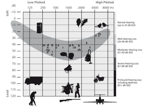 Phonak Hearing Aid Comparison Chart